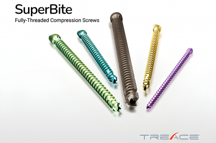 Treace Launches SuperBite™ Compression Screw System to Open a New Chapter in Foot Orthopaedics Treace Launches SuperBite™ Compression Screw System to Open a New Chapter in Foot Orthopaedics
